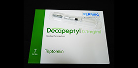 Decapeptyl使用の手順